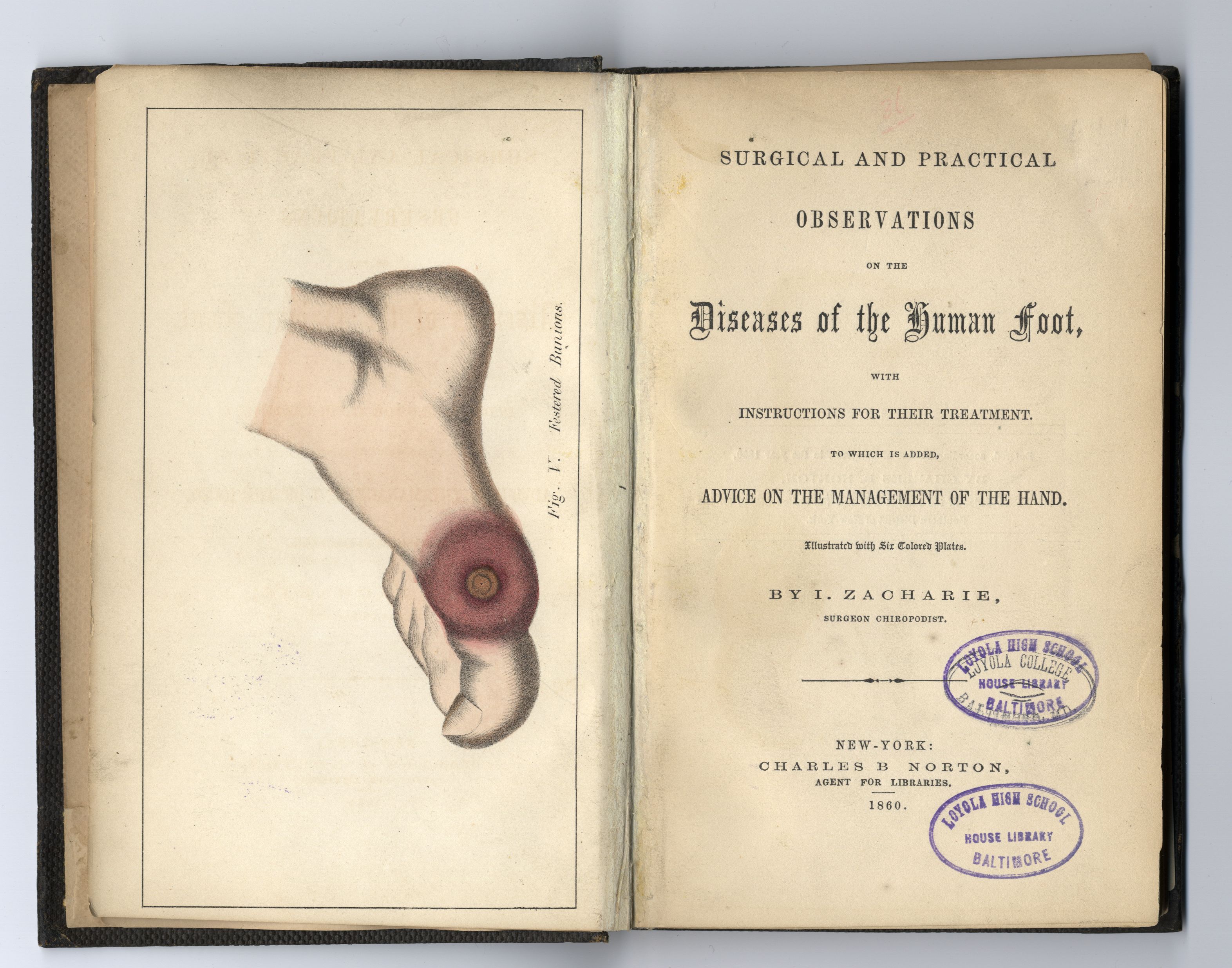 Rare Signed Copy of Lincoln's Jewish Chiropodist and Spy, Dr. Issachar Zacharie's Book
